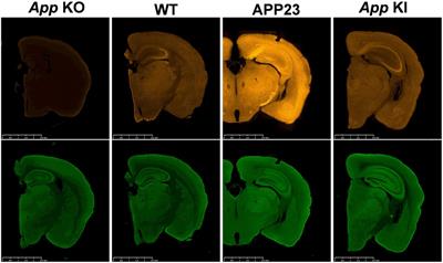 Recent Advances in the Modeling of Alzheimer’s Disease